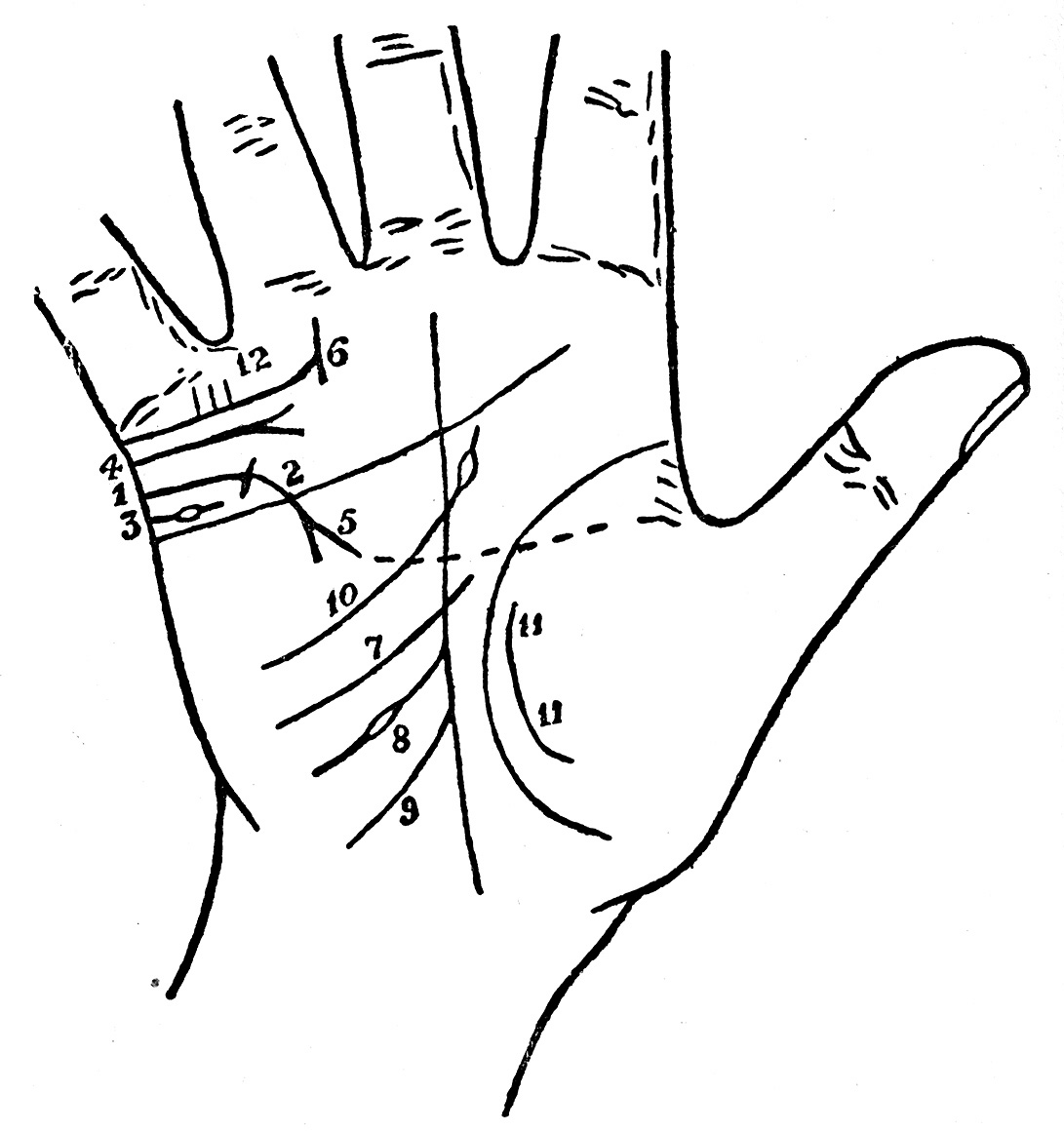 Plate XVIII from Cheiro's Palmistry for All (1916): broken marriage lines, overlapping breaks read as reconciliation, and influence lines that further help in denoting marriage